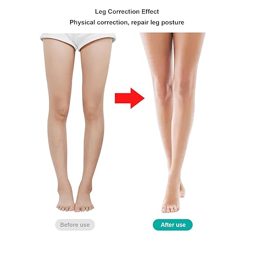 Leg Correction Belt, Ventilated Hook and Loop Fixed X Leg Type Corrector Elastic Band for Kids