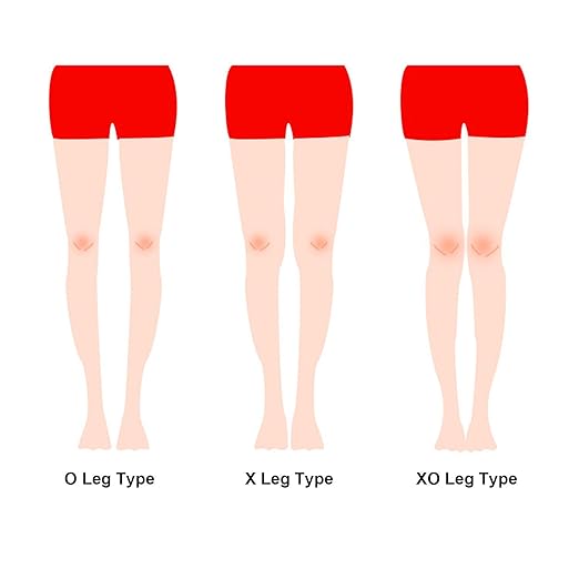 Leg Correction Belt, Ventilated Hook and Loop Fixed X Leg Type Corrector Elastic Band for Kids