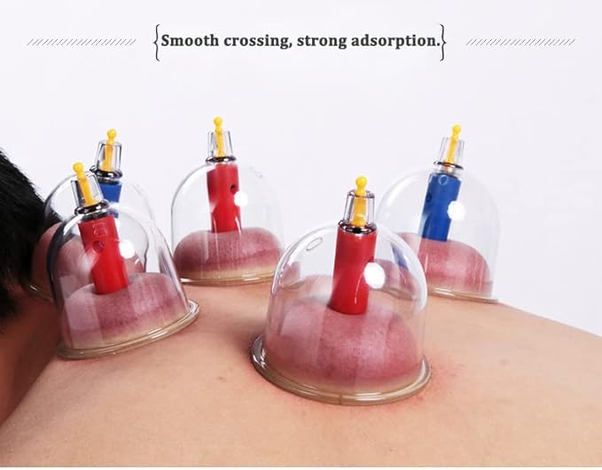 Kangzhu 24-Cup Biomagnetic Chinese Cupping Therapy Set