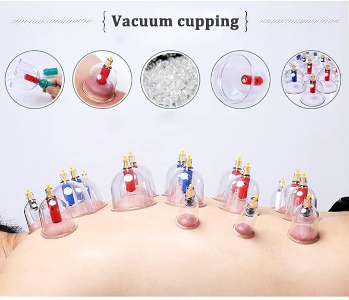 Kangzhu 24-Cup Biomagnetic Chinese Cupping Therapy Set