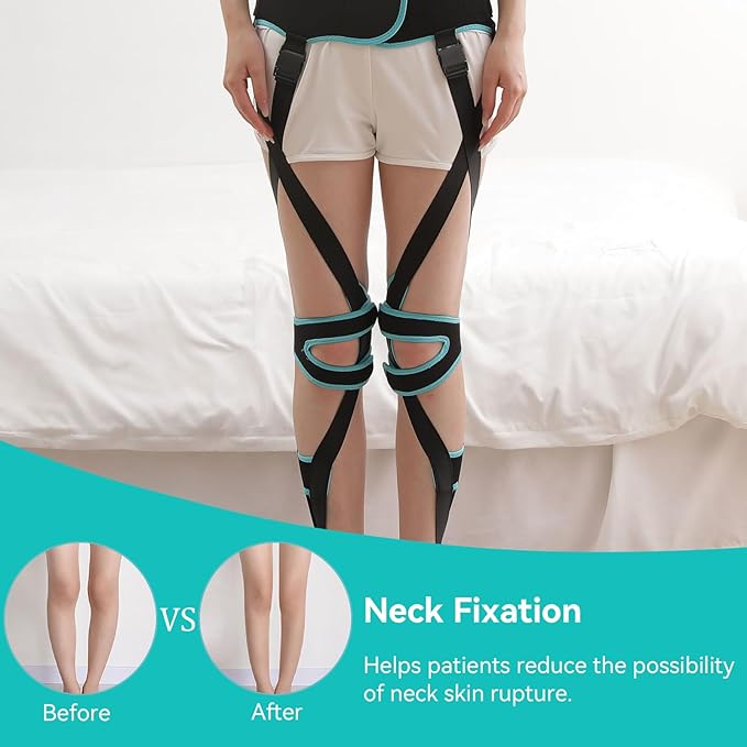 Agatige Leg Corrector Strap, High Elasticity O X Type Leg Correction Bandage Legs Posture Corrector Brace Foot Correction Belt for Adults(L(59.1-66.9in))