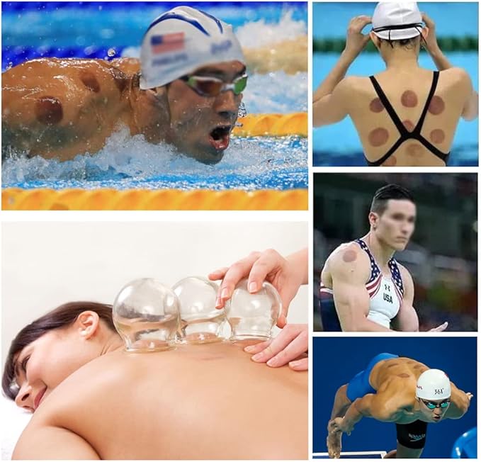 Cupping Therapy Sets,14 Cups Thick Chinese Acupoint Glass Cupping Therapy Set for Professionals,for Massage Back and Relieve Fatigue