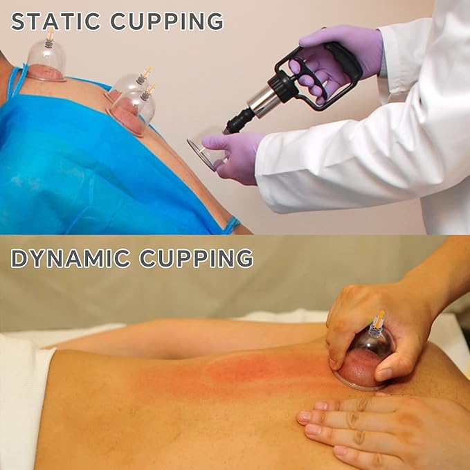 Cupping Therapy Set, 24 Massage Cups Cupping Set with Pump Vacuum Suction Cups for Body Cellulite Massage Back Pain Relief, Chinese Acupoint Physical Hijama
