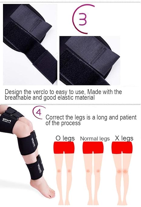O/X Leg Type Correction Belt- 3 In 1 Adjustable Legs Posture Corrector Belt Knock Knees Shape Straightening Band Bandage