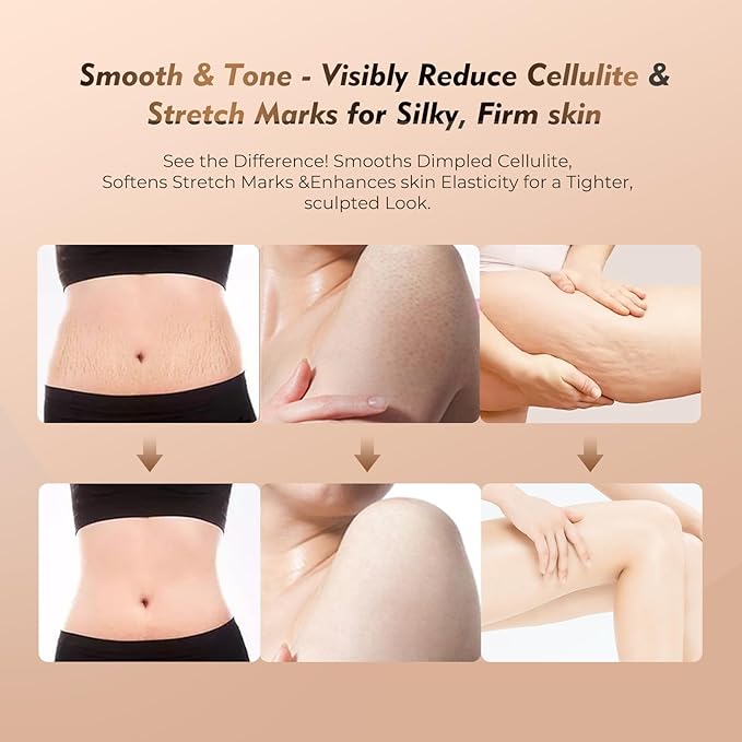 35-Speed Lymphatic Drainage Massager for Body Sculpting - 3-in-1 Anti-Cellulite Massage Device with Vibration, Heat & Microcurrent - Deep Tissue Skin Renewal Tool for Stomach, Arms & Thighs