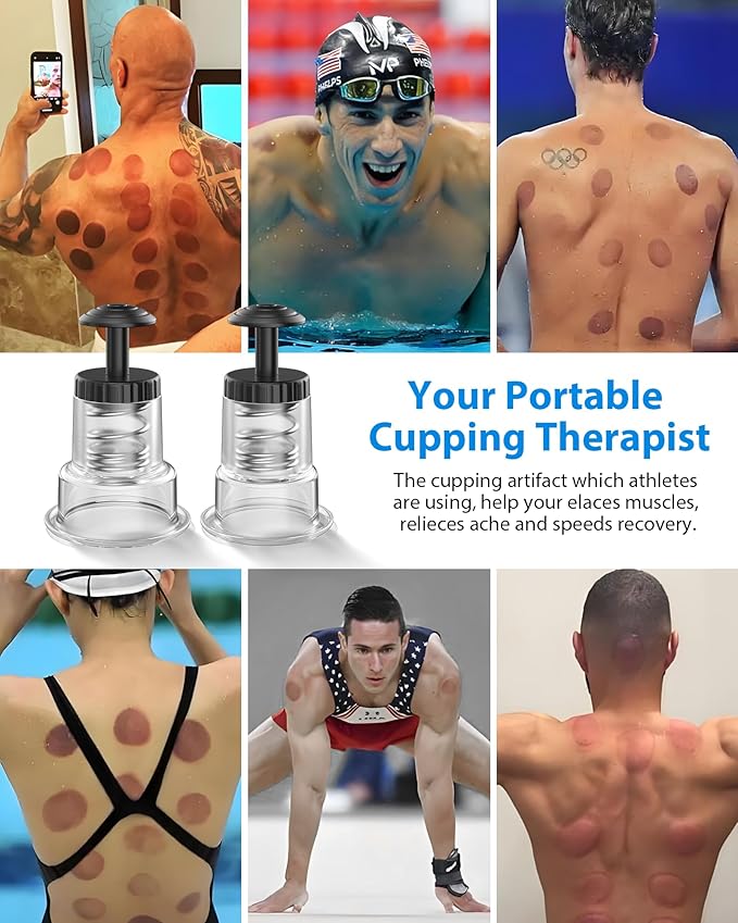 Cupping Kit for Massage Therapy, 2 Sizes Cupping Set, Unique Piston Design, Portable Massager for Studio & Home Use, Muscle Pain Relief, Myofascial Release, Cellulite Reduction (2 Pack)