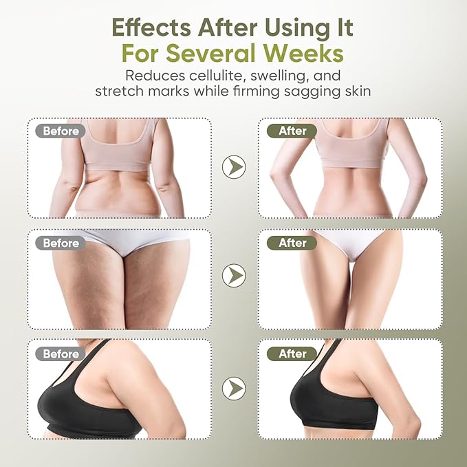 Lymphatic Drainage Massager & Anti-Cellulite Tool - Body Sculpting Machine with Microcurrent, Light, Heat & Vibration for Legs, Arms, Belly | Reduces Stretch Marks & Cellulite