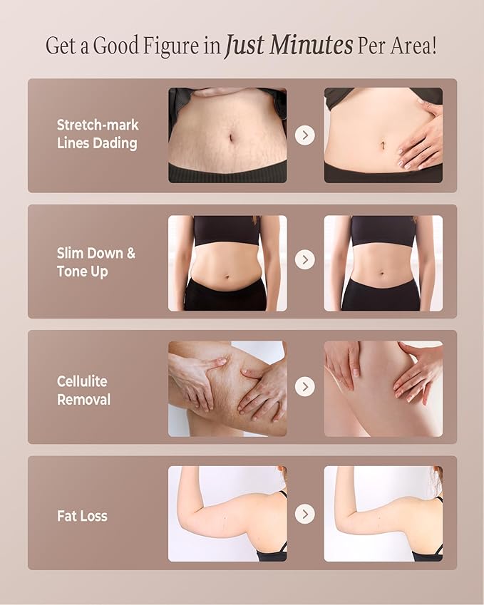 3-in-1 Body Sculpting Machine for Cellulite Appearance, Electric Cellulite Massage Tool for Legs Belly Stomach Arms, Home Use Body Sculptor Device with 3 Cups for Skin Firming, Circulation