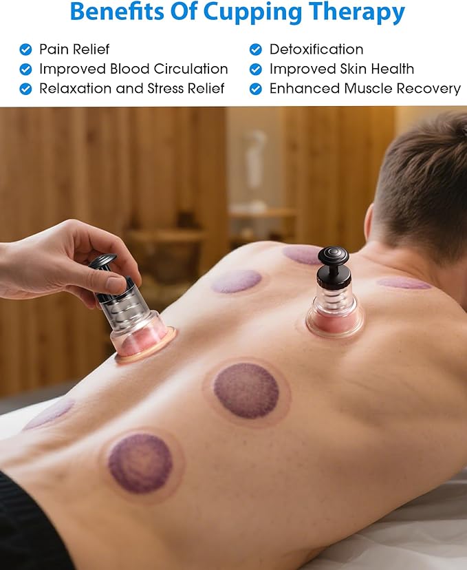 Cupping Kit for Massage Therapy, 2 Sizes Cupping Set, Unique Piston Design, Portable Massager for Studio & Home Use, Muscle Pain Relief, Myofascial Release, Cellulite Reduction (6 Pack)