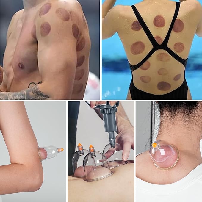 Ditind Cupping Therapy Set, 24 Pcs Cupping Set, Professional Cupping Kit for Massage Therapy, Portable Upgrade Cupping with Case, Pump Suction Cups for Cellulite Muscle Pain Relief Physical Therapy