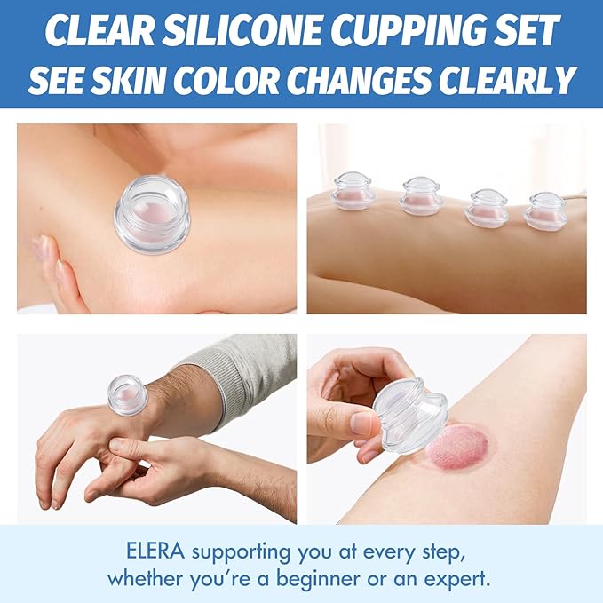 ELERA Cupping Kit for Massage Therapy – Silicone Cupping Therapy Set with 3 Massage Cups (S/M/L), Ideal for Cellulite, Relaxation & Daily Self-Care
