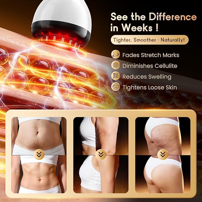 Lymphatic Drainage Massager & Anti Cellulite Massage Tool, Helps Reduce Stretch Marks & Cellulite, for Legs, Arms & Belly, Body Sculpting Machine with Microcurrent & Red-Light & Heat & Vibration