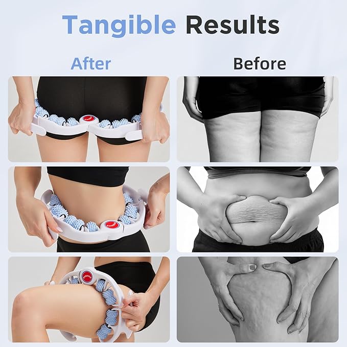 Cellulite Massage Tool - Lymphatic Drainage Massager - Muscle Roller, Deep Fascia Massage, Dimpled Skin Removal, Legs/Thighs/Buttocks, Anti-Cellulite Roller, Smooth Skin, Pain Relief (Blue)