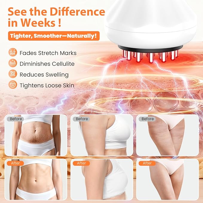 Lymphatic Drainage Massager, Anti-Cellulite Massager For Body Cellulite and Thigh & Belly Stretch Marks Reduction, Handheld Massage tools for lymphedema & lipedema, Sciatica Nerve pain relief Devices