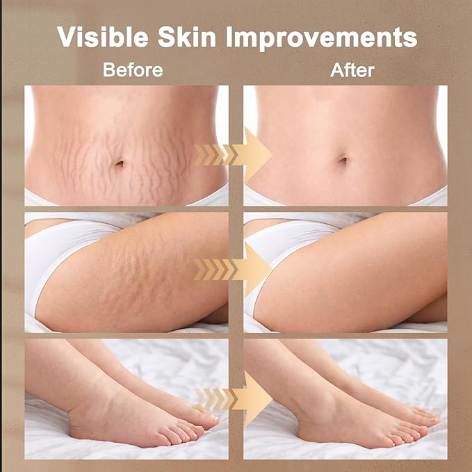 Lymphatic Drainage Massager, Lymphatic Massager, Helps Reduce Stretch Marks & Cellulite, for Legs, Arms & Belly, Body Sculpting Machine with Microcurrent, Light, Heat & Vibration, White