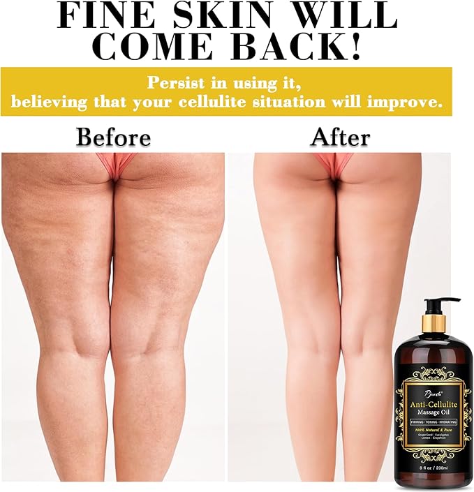 Anti Cellulite Massage Oil with Massager, Collagen and Stem Cell Skin Tightening Oil Natural Cellulite Remover Therapy Oil for Cellulite & Stretch Mark(Anti Cellulite Massage Oil Kit)