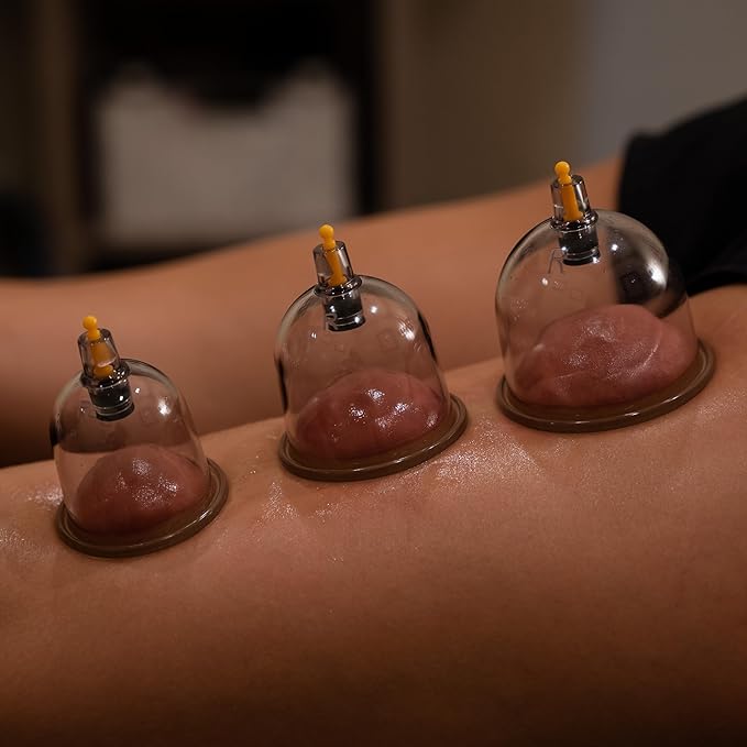 Myofascial Releaser Professional Cupping Therapy Set - 18 Multi-Sized Vacuum Cups with Two Hand Pumps and Detailed Cupping Book - Massage Cupping Set for Massage Therapists