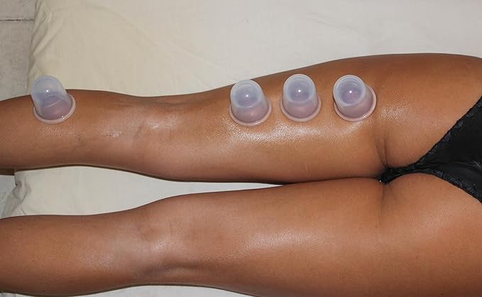 Silicone Cupping Therapy Set - Massage Therapy Cups for Arthritis, Pain Relief, Anti Aging, and Anti-Cellulite - Cupping Kit for Relaxation and Muscle Recovery