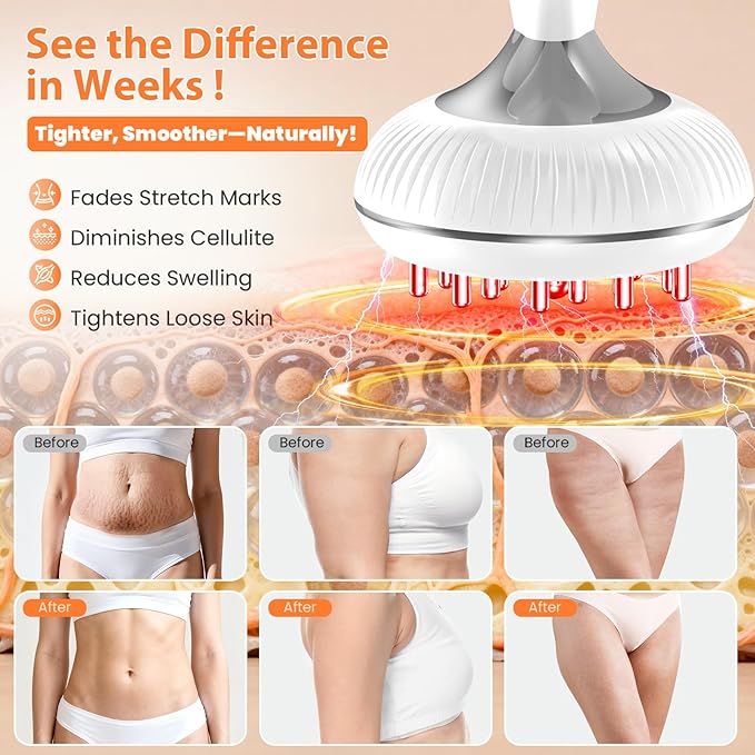 Lymphatic Drainage Massager, Anti-Cellulite Massager For Body Cellulite and Thigh & Belly Stretch Marks Reduction, Handheld Massage tools for lymphedema & lipedema, Sciatica Nerve pain relief Devices