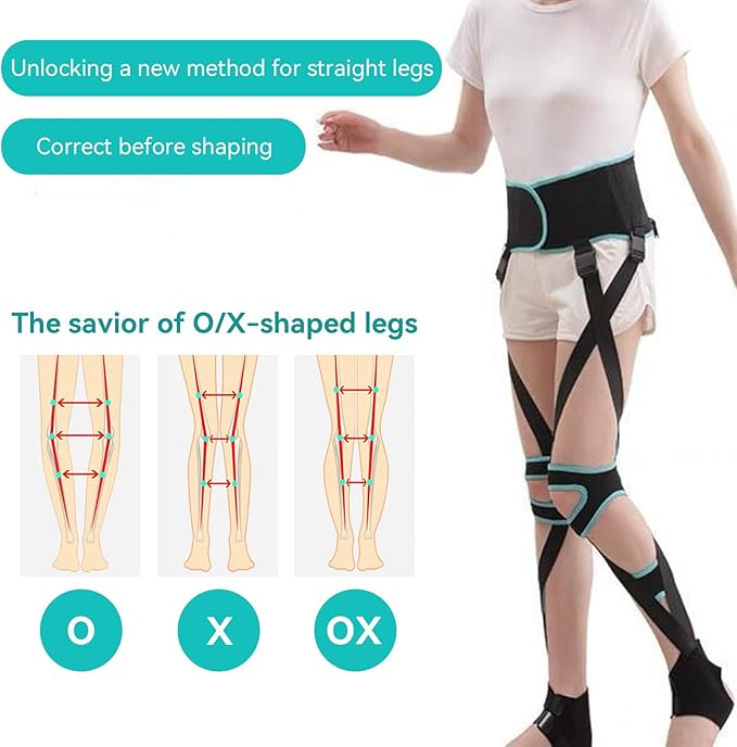 Leg Corrector Strap, High Elasticity O X Type Leg Correction Bandage Legs Posture Corrector Brace Foot Correction Belt for Adults(M(51.2-59.1in))