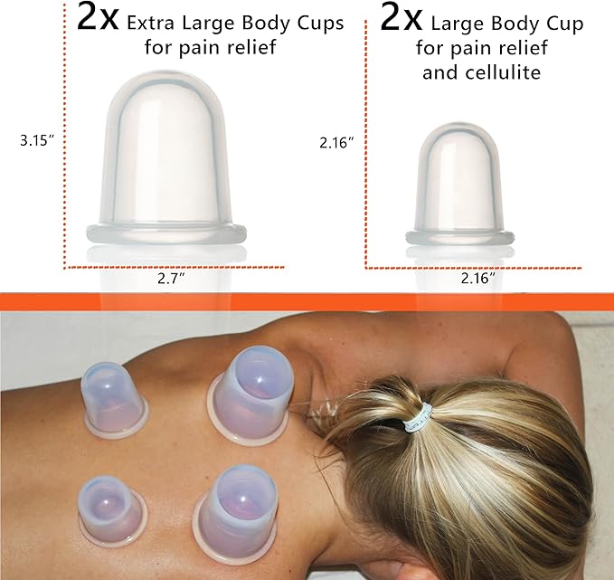 Silicone Cupping Therapy Set – 4 Massage Cups (2 XL, 2 L) – Pain Relief, Muscle Recovery & Cellulite Reduction – Professional Cupping Kit for Home, Gym & Athletes