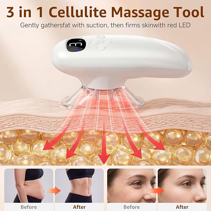 Body Smart Scraping,3 in 1 Body Sculpting Machine,Cellulite Removal Machine,Body Sculptor,Suitable for Legs, Abdomen,Arms, Love Handles,Relieves Muscle Tension and Tightens Skin,cellulite massage tool