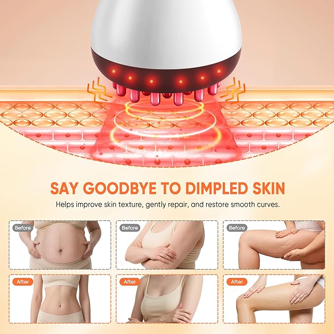 Lymphatic Drainage Massager & Anti Cellulite Massage Tool,Fascia Blaster for Cellulite,Helps Reduce Stretch Marks for Legs, Arms & Belly,Body Sculpting Machine with Microcurrent, Light, Vibration
